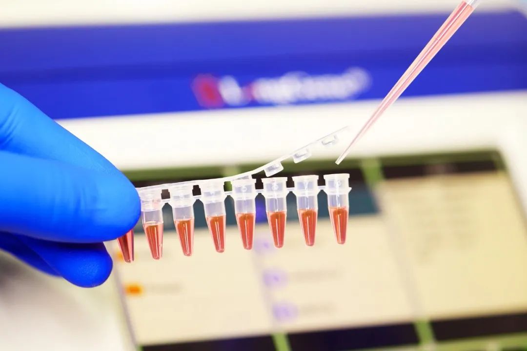 Jinsi ya kuchagua matumizi ya PCR/qPCR?